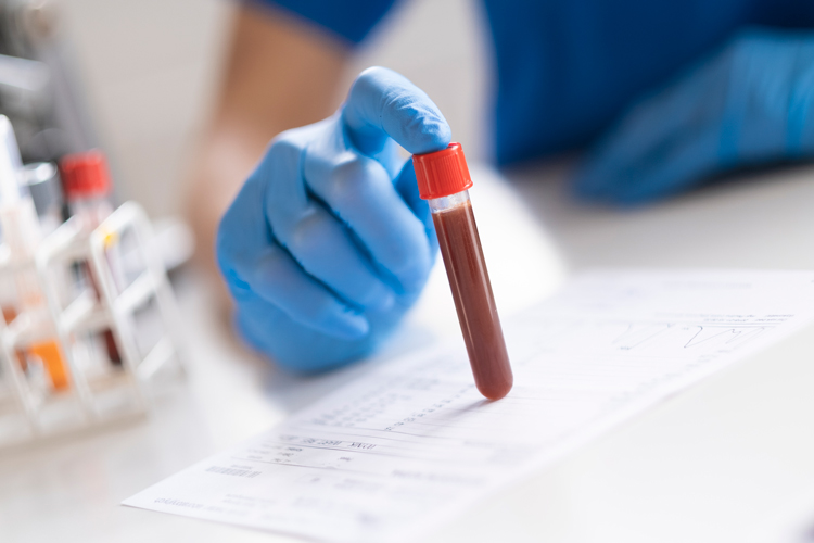 Blood Tests – The Marion Gluck Clinic