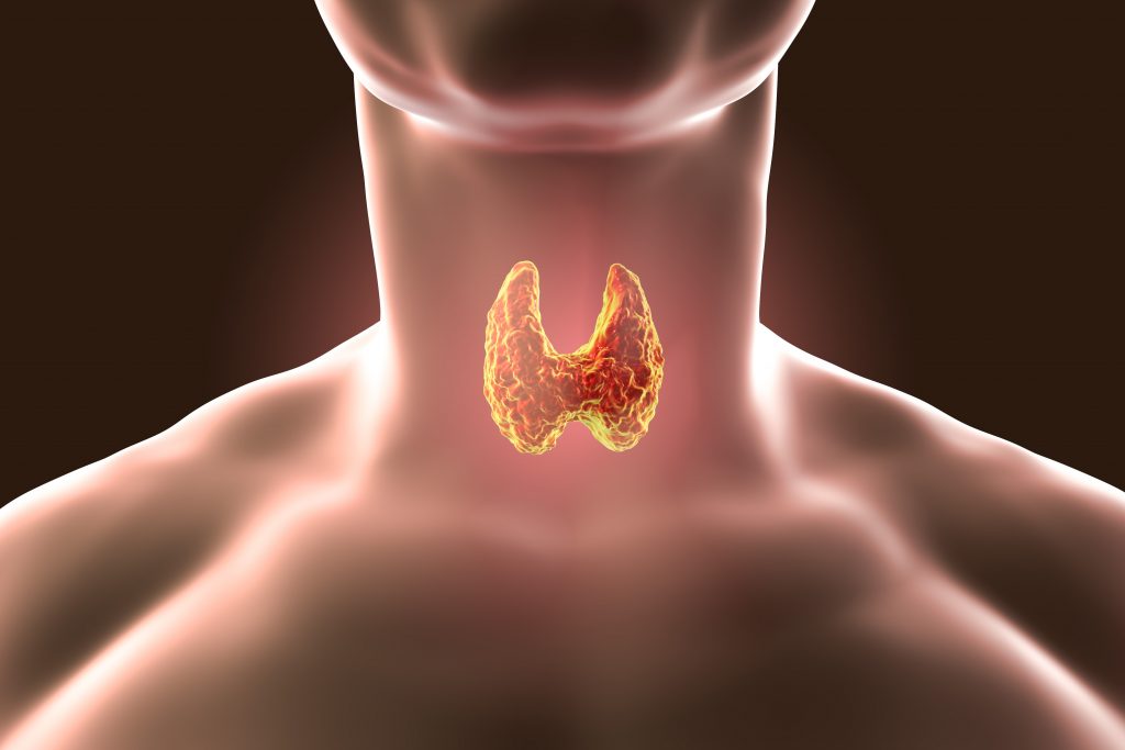 hypothyroidism