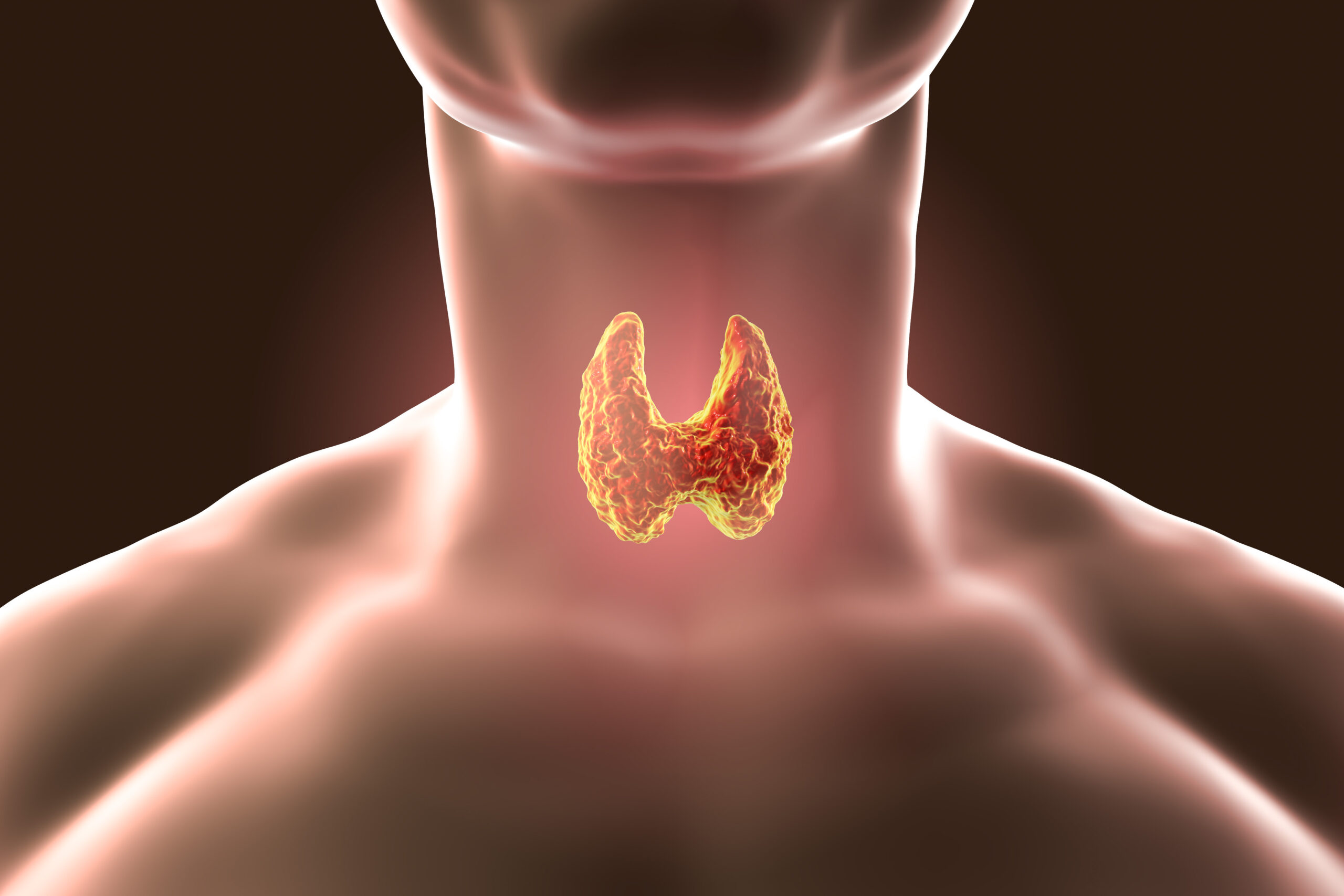 Symptoms of Thyroid Dysfunction You Might Not Expect - Marion Gluck